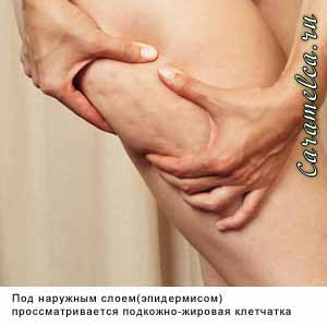 Гиподерма на рисунке, фотографии